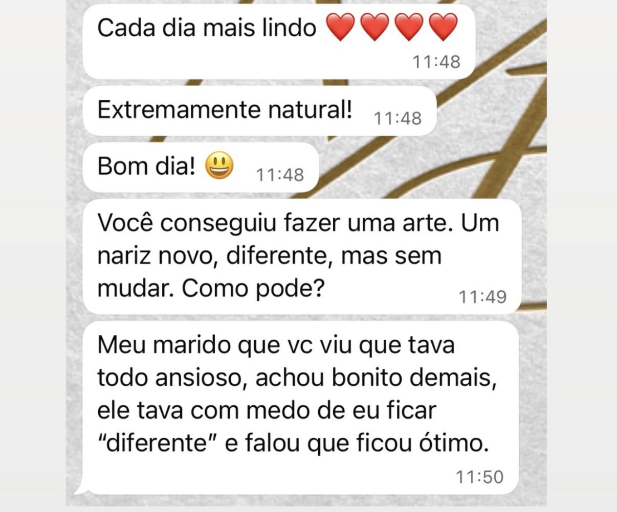 Depoimento autorizado sobre resultado natural de rinoplastia